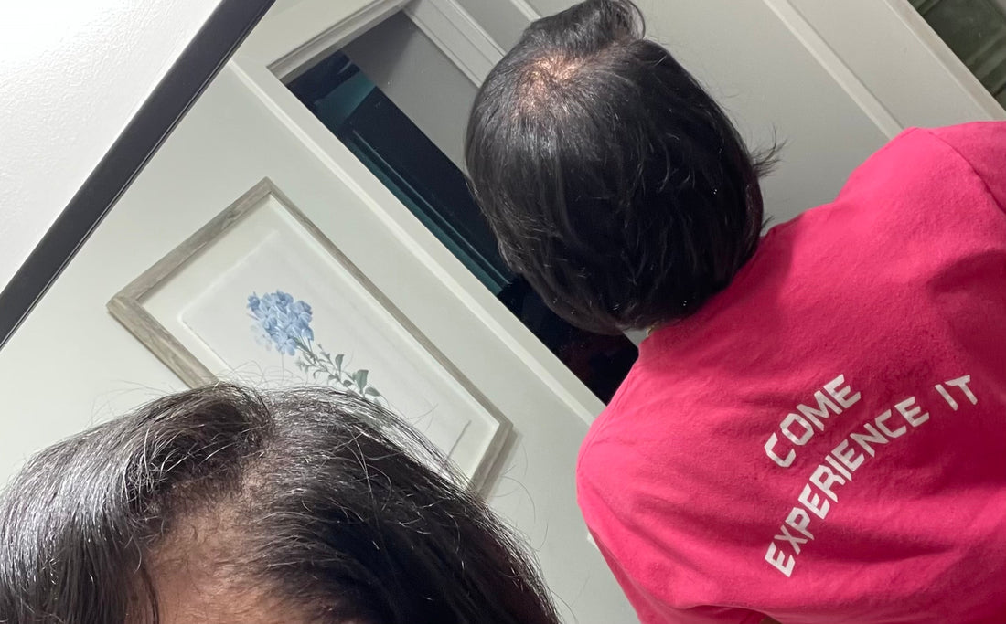 From Denial to Acceptance: Understanding the Emotional Stages of Hair Loss
